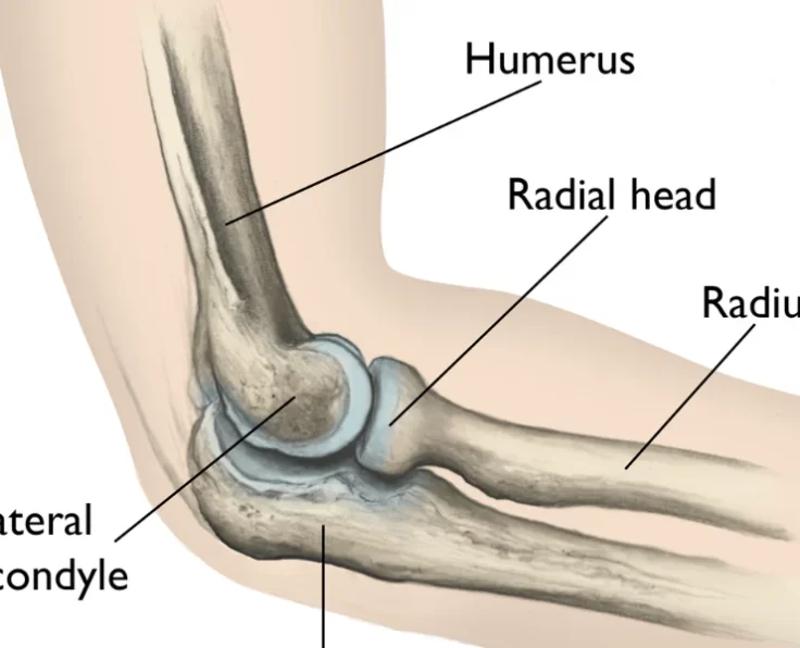 complex-fractures-in-radial-head