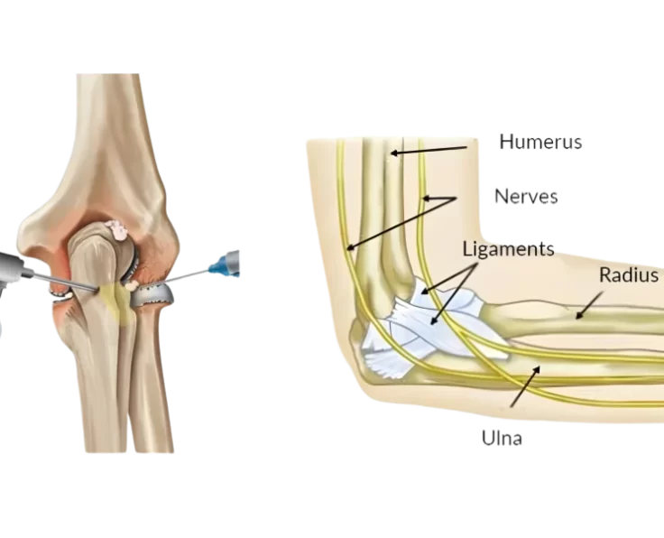 elbow-arthroscopy-ok-procedure