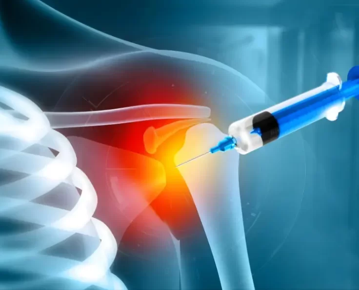 hydrodilation-of-shoulder