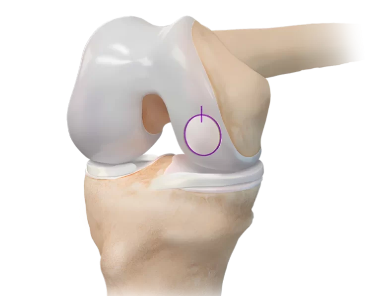 oats-for-elbow-and-shoulder