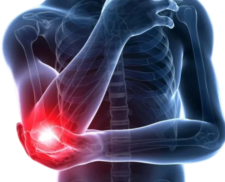 prime-elbow-pain
