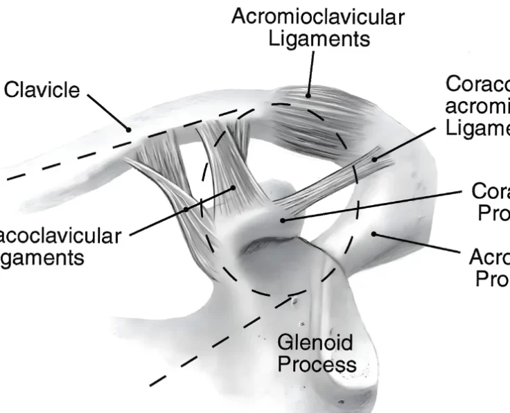 terrible-triad-in-elbow